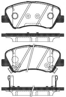 Колодки тормозные диск. перед. (Remsa) Hyundai Accent (10-), i20 (14-), Kia Rio (11-) (17-) WOKING P15883.02